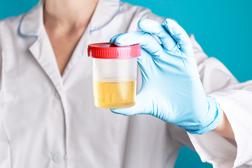 5 Ways To Test Kratom On Drug Test
